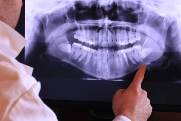 Best Broken or Cracked Tooth Emergency Dentist in Dellwood, MO